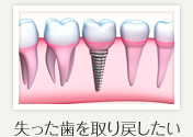 失った歯を取り戻したい