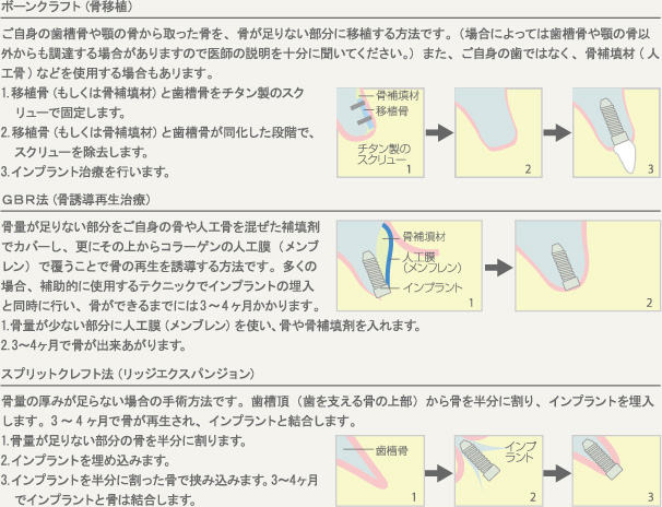 補助手術