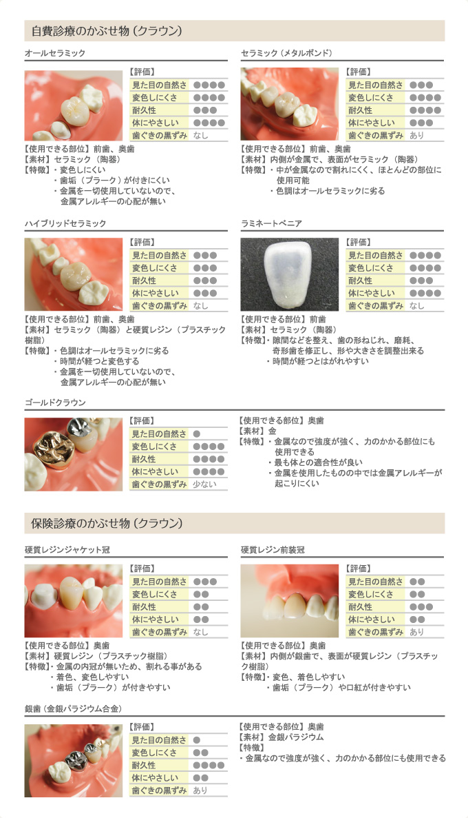 かぶせ物