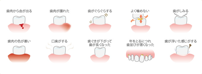 歯周病の症状